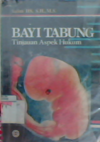 Bayi tabung tinjauan aspek hukum